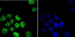 HDAC9 Antibody in Immunocytochemistry (ICC/IF)