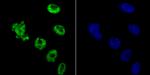 HDAC9 Antibody in Immunocytochemistry (ICC/IF)