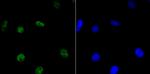 HDAC9 Antibody in Immunocytochemistry (ICC/IF)