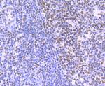 HDAC9 Antibody in Immunohistochemistry (Paraffin) (IHC (P))