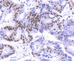 HDAC9 Antibody in Immunohistochemistry (Paraffin) (IHC (P))