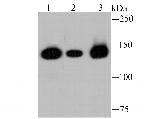 HDAC9 Antibody in Western Blot (WB)