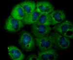 USP14 Antibody in Immunocytochemistry (ICC/IF)