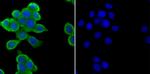 Zap-70 Antibody in Immunocytochemistry (ICC/IF)