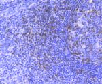 Zap-70 Antibody in Immunohistochemistry (Paraffin) (IHC (P))