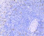 Zap-70 Antibody in Immunohistochemistry (Paraffin) (IHC (P))