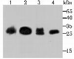 Carbonic anhydrase II Antibody in Western Blot (WB)