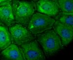 TPT1 Antibody in Immunocytochemistry (ICC/IF)