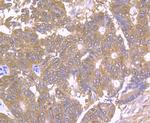 TPT1 Antibody in Immunohistochemistry (Paraffin) (IHC (P))