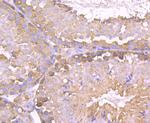 TPT1 Antibody in Immunohistochemistry (Paraffin) (IHC (P))