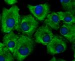 Growth Hormone Receptor Antibody in Immunocytochemistry (ICC/IF)