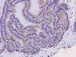 SQSTM1 Antibody in Immunohistochemistry (Paraffin) (IHC (P))