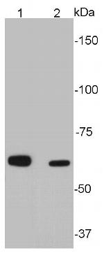 SQSTM1 Antibody in Western Blot (WB)