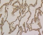 ORM1 Antibody in Immunohistochemistry (Paraffin) (IHC (P))