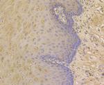 ORM1 Antibody in Immunohistochemistry (Paraffin) (IHC (P))