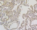 ORM1 Antibody in Immunohistochemistry (Paraffin) (IHC (P))