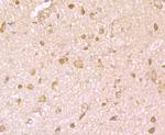 IGF2BP3 Antibody in Immunohistochemistry (Paraffin) (IHC (P))