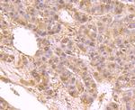 IGF2BP3 Antibody in Immunohistochemistry (Paraffin) (IHC (P))