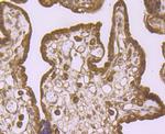 IGF2BP3 Antibody in Immunohistochemistry (Paraffin) (IHC (P))