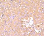 TIM-3 Antibody in Immunohistochemistry (Paraffin) (IHC (P))