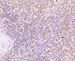 TIM-3 Antibody in Immunohistochemistry (Paraffin) (IHC (P))