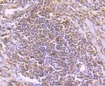 TIM-3 Antibody in Immunohistochemistry (Paraffin) (IHC (P))