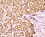 PCSK9 Antibody in Immunohistochemistry (Paraffin) (IHC (P))