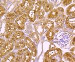 PCSK9 Antibody in Immunohistochemistry (Paraffin) (IHC (P))