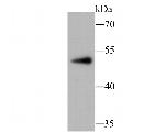 PCSK9 Antibody in Western Blot (WB)