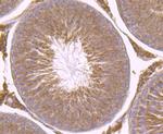 B-Raf Antibody in Immunohistochemistry (Paraffin) (IHC (P))