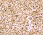 B-Raf Antibody in Immunohistochemistry (Paraffin) (IHC (P))