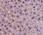 PRMT5 Antibody in Immunohistochemistry (Paraffin) (IHC (P))