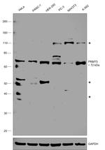 PRMT5 Antibody in Western Blot (WB)