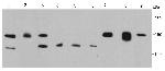 FGFR2 Antibody in Western Blot (WB)