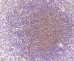 PKC beta-1 Antibody in Immunohistochemistry (Paraffin) (IHC (P))