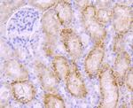 PKC beta-1 Antibody in Immunohistochemistry (Paraffin) (IHC (P))