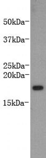 TNF beta Antibody in Western Blot (WB)