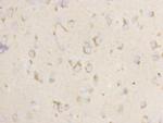 CD304 (Neuropilin-1) Antibody in Immunohistochemistry (Paraffin) (IHC (P))