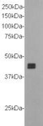 CD304 (Neuropilin-1) Antibody in Western Blot (WB)