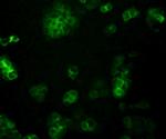 PIEZO1 Antibody in Immunocytochemistry (ICC/IF)