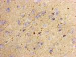 Lass2 Antibody in Immunohistochemistry (Paraffin) (IHC (P))