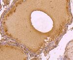 C14orf93 Antibody in Immunohistochemistry (Paraffin) (IHC (P))