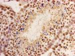 CHD1 Antibody in Immunohistochemistry (Paraffin) (IHC (P))