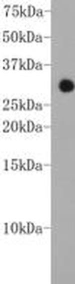 CHD1 Antibody in Western Blot (WB)