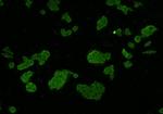 Axl Antibody in Immunocytochemistry (ICC/IF)