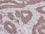 ALDH2 Antibody in Immunohistochemistry (Paraffin) (IHC (P))