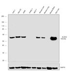 ALDH2 Antibody