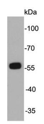 ALDH2 Antibody in Western Blot (WB)