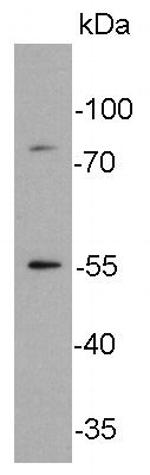 GLUT4 Antibody in Western Blot (WB)