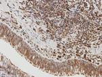 SIRT1 Antibody in Immunohistochemistry (Paraffin) (IHC (P))